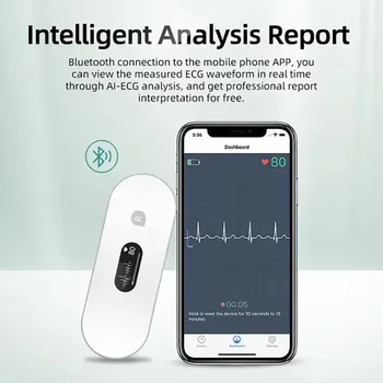 Портативный монитор ЭКГ OLED Bluetooth ЭКГ Cardiaco Мониторинг сердца Носимая электрокардиограмма Неограниченное хранилище данных Поделиться